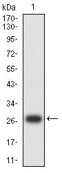 Figure 2: Western blot analysis using CD21 mAb against human CD21 (AA: extra 740-964) recombinant protein. (Expected MW is 27.6 kDa)