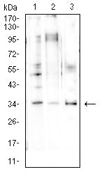Figure 4: Western blot analysis using CCND1 mouse mAb against LNCAP (1), A431 (2), and NIH/3T3 (3) cell lysate.