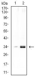 Figure 5: Western blot analysis using CCND1 mouse mAb against LNCAP (1), and NIH/3T3 (2) cell lysate.