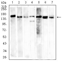 Figure 4: Western blot analysis using MSH6 mouse mAb against SH-SY5Y (1), K562 (2), Hela (3), PC-3 (4), HCT116 (5), HEK293 (6), and A549 (7) cell lysate.
