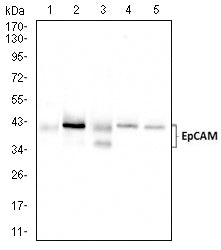 Figure 4: Western blot analysis using EPCAM mouse mAb against HCT116 (1), HT-29 (2),SW480 (3),Sw-620 (4) , and T47D (5) cell lysate.