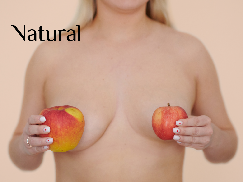 Symmetrista: Asymmetrical bras for uneven breasts