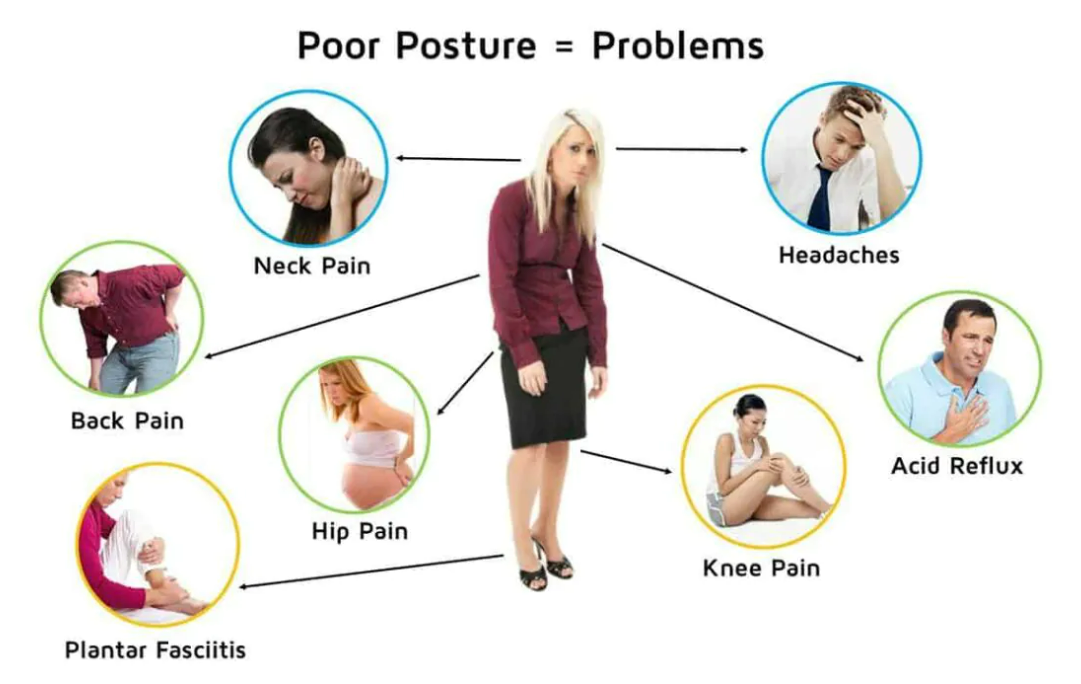 Kan swak postuur tot chroniese pyn lei? | Soortgelyke metodes om jou posturale welstand te verbeter | BronIT