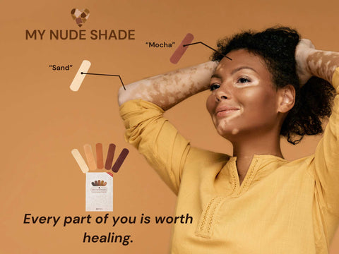 A Black woman with vitiligo and bandages matching her skin.
