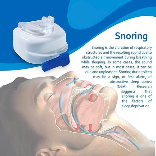 Sleep Apnea Mouthpiece Moldable Anti Snoring Mouth Guard Snore Stop Aroflit