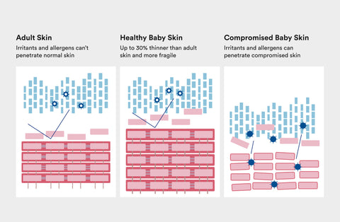 baby skin prone to irritation