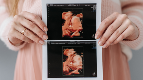 pregnant woman holding ultrasound photos