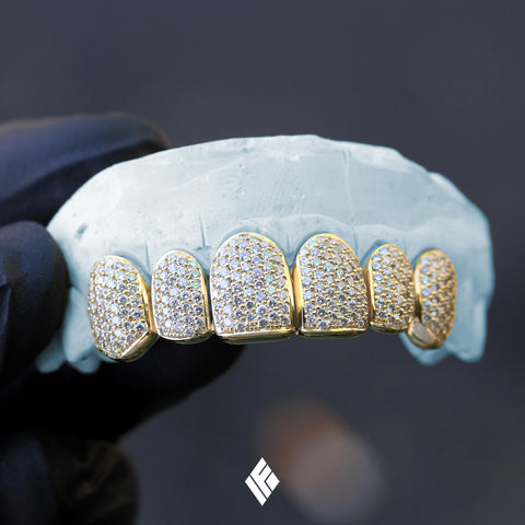 Yellow Gold Deep-Cut Upper 6 Teeth Diamond Grillz