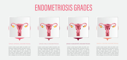 Viviendo con endometriosis: cuidados y manejo