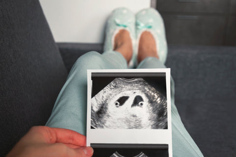 Con las FIVs, aumentan los riesgos de nacimientos múltiples, si se transfiere más de un embrión al útero. (Imagen de Freepik)