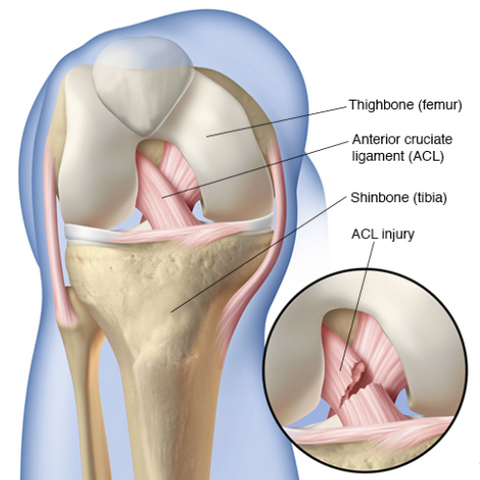 Anterior Cruciate Ligament