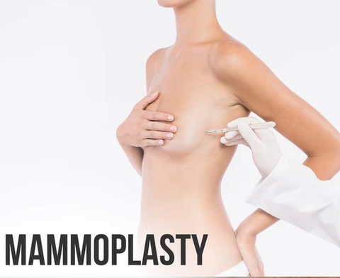 Mammoplasty