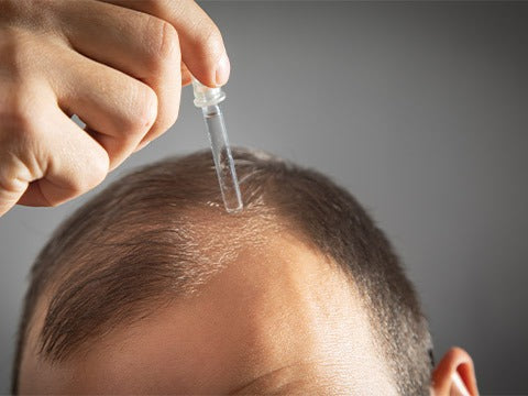 Hair Oiling On Men Head