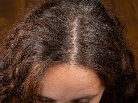 Dry Hair Scalp