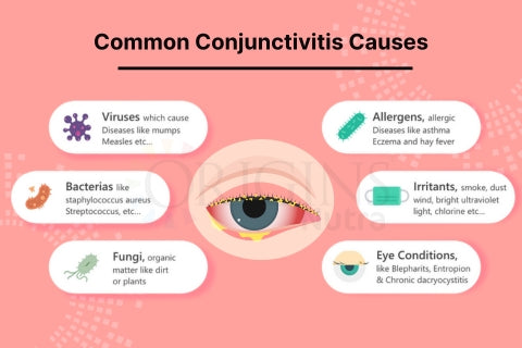 Types Of Conjuctivitis