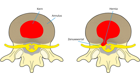 annulus dwarsdoorsnede bovenaf