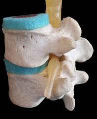 normaal foramen met daarin de zenuwwortel