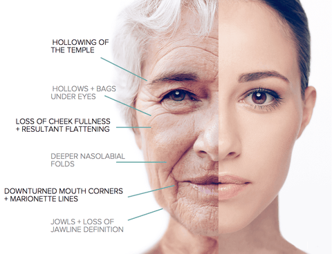 Facial Lines Anti-aging
