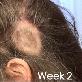 CPO™ Серум за подхранване на фоликулите за растеж на косата