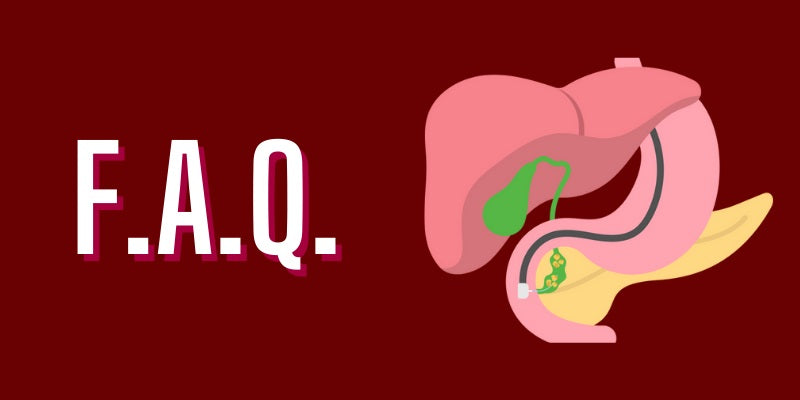 F.A.Q- about Gallstones