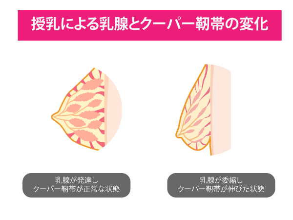 授乳後のバスト