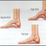 Flat Feet