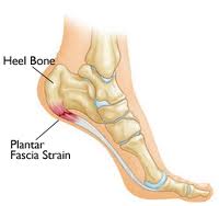 shoes for plantar fasciitis