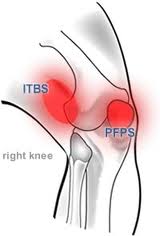 runners knee-knee pain