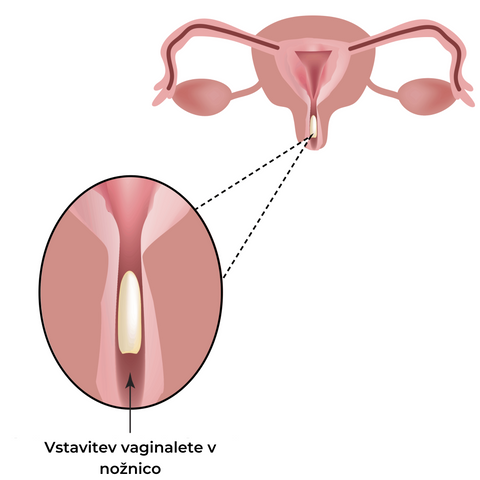navodila za uporabo vaginalet bioapigyn