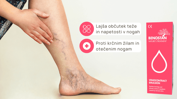 Venocontract - Gel za krčne žile 125 mL