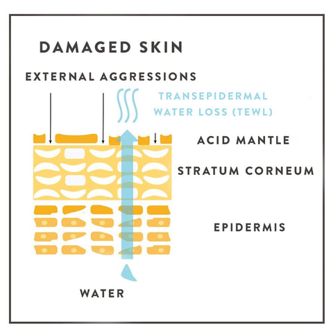 blog-damaged-skin-barrier-how-it-looks-TEWL-transedpidermal-water-loss