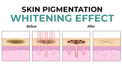SkinFerm™ Collagen Milk Whitening Soap