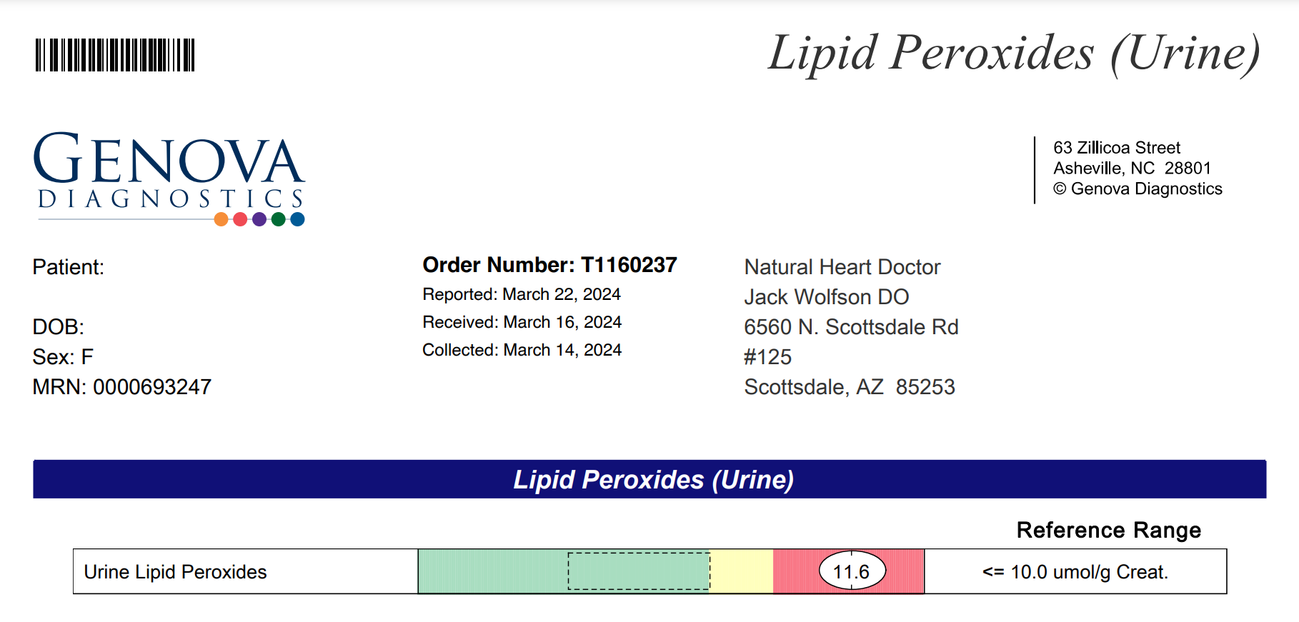 Lipid Peroxice Results