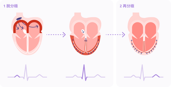 cardiac-depolarization-repolarization