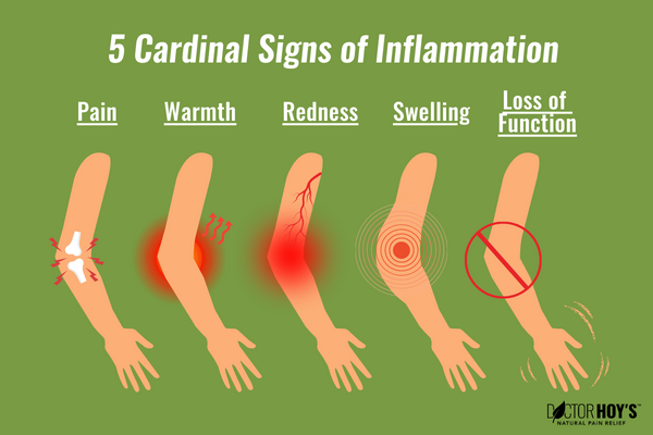 Illustration showing person’s arm five times with each of the 5 signs of inflammation