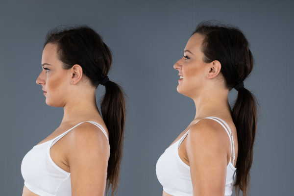 Woman tucking in chin then standing with chin out