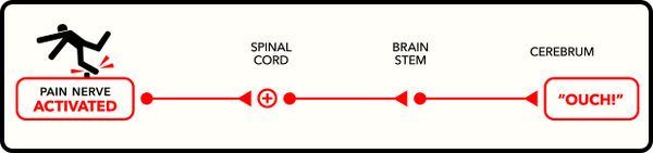 Diagram of painful stimuli going to the spinal cord, brain stem, and brain