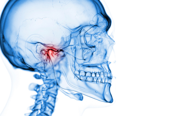 X-ray image of the temporomandibular joint on a skull
