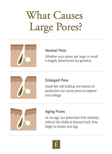 what causes large pores?