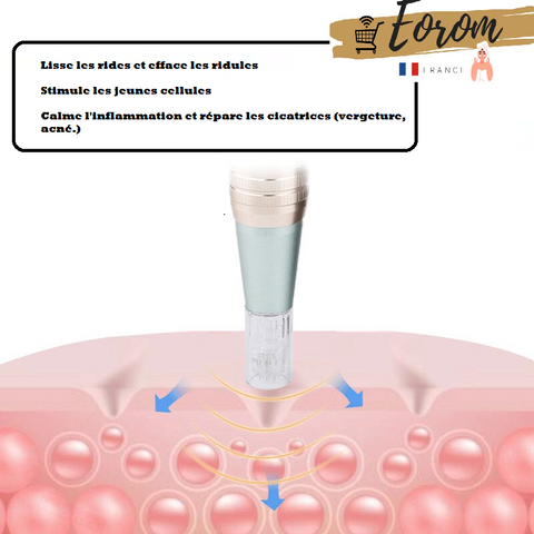 microneedling microneedling avant aprés anti cellulite derma pen anti ride anti cellulite anti ride traitement choc traitement cellulite traitement anti cellulite derma pen anti ride ventouse anti cellulite traitement choc cellulite traitement cellulite traitement choc cellulite traitement cellulite rides yeux Mmicroneeding visage microneedling vergetures soin anti cellulite  soin anti ride microneedling maison traitement anti cellulite traitement anti cellulite microneedling vergetures avant après sérum acide hyaluronique gel aloe vera