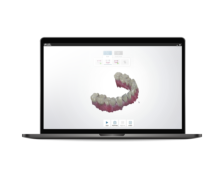 Digitale Abformung mit CAD/CAM Intraoral Scanner