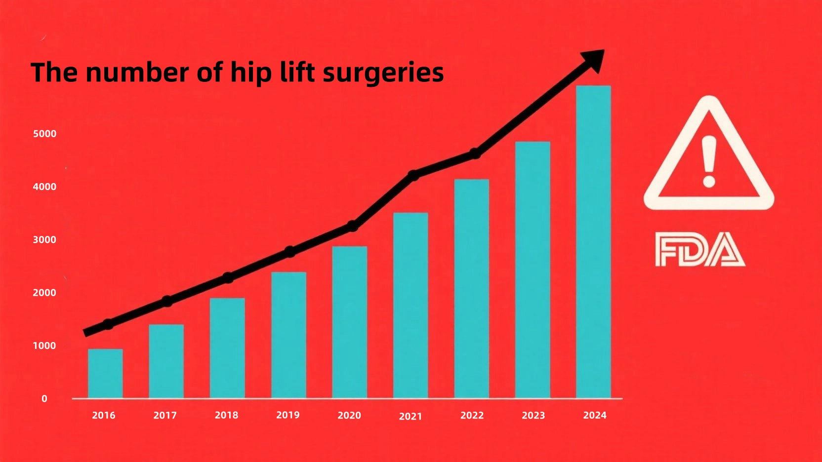 The increasing number of hip augmentation surgeries year by year