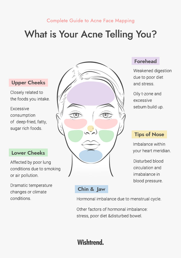 Want to save time? Look into the mirror now, where do you spot acne?