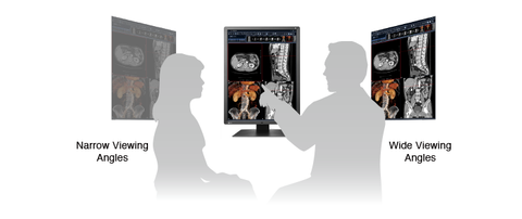 Comfortably View from Any Angle - EIZO RadiForce RX250 2MP LCD LED Color Display available at ERI