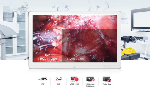 A Display Optimized for Compatibility - LG 27HK510S-W 27-inch Full HD LED Surgical Display available at ERI