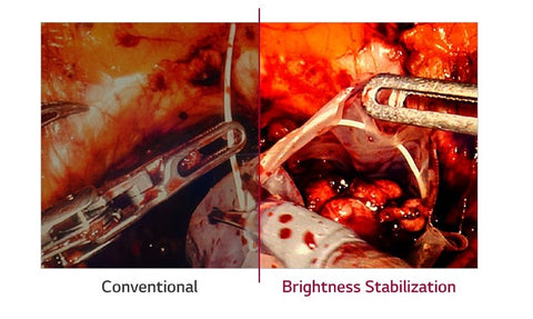 Brightness Stabilization - LG 27HK510S-W 27-inch Full HD LED Surgical Display available at ERI