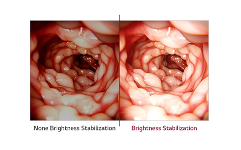 Brightness Stabilization - LG 31.5-inch 4K IPS Surgical Monitor available at ERI