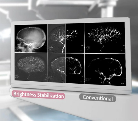 DICOM Part 14 & Brightness Stabilization - LG 27HJ713S-W 27" 4K LED Surgical Display available at ERI
