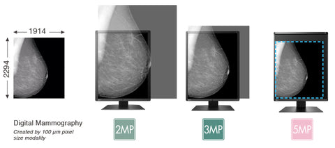 View Mammography Images Clearly - EIZO RadiForce GX560 5MP Monochrome Monitor available at ERI