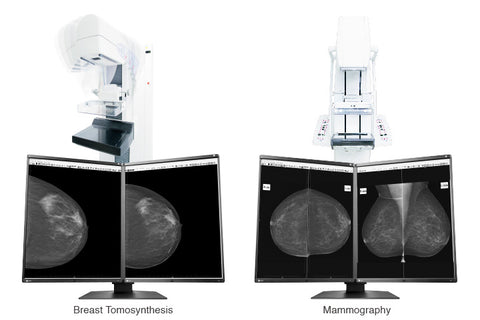 Optimum Breast Screening Monitor - EIZO RadiForce GX560 5MP Monochrome Monitor available at ERI